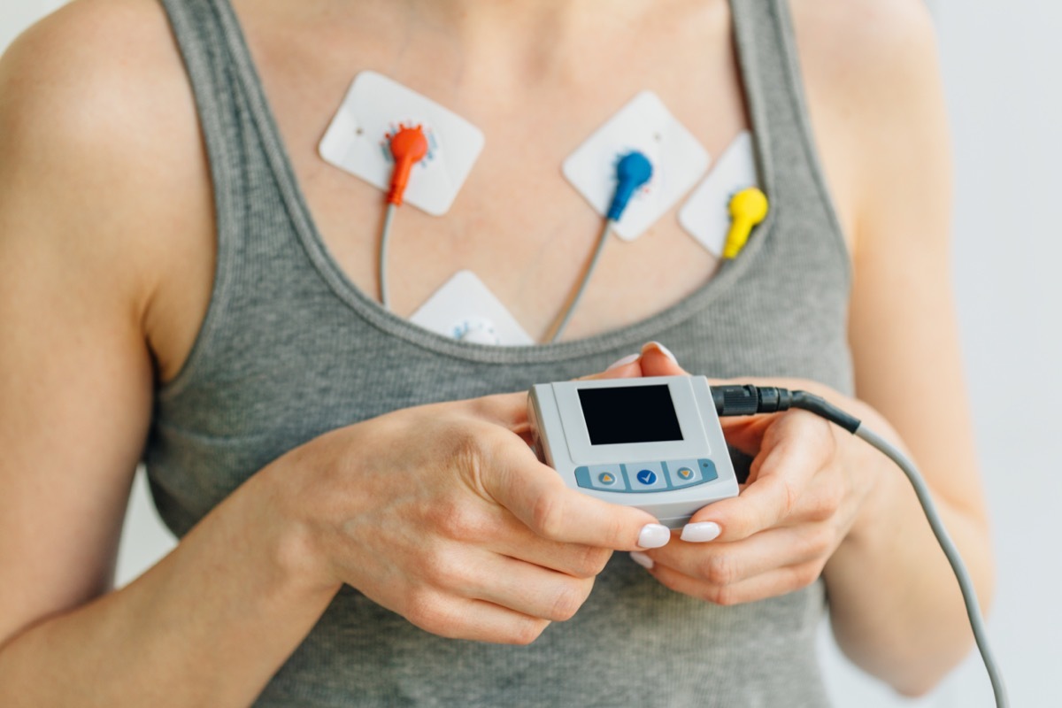 Woman wearing holter monitor device for daily monitoring of an electrocardiogram. Treatment of heart diseases