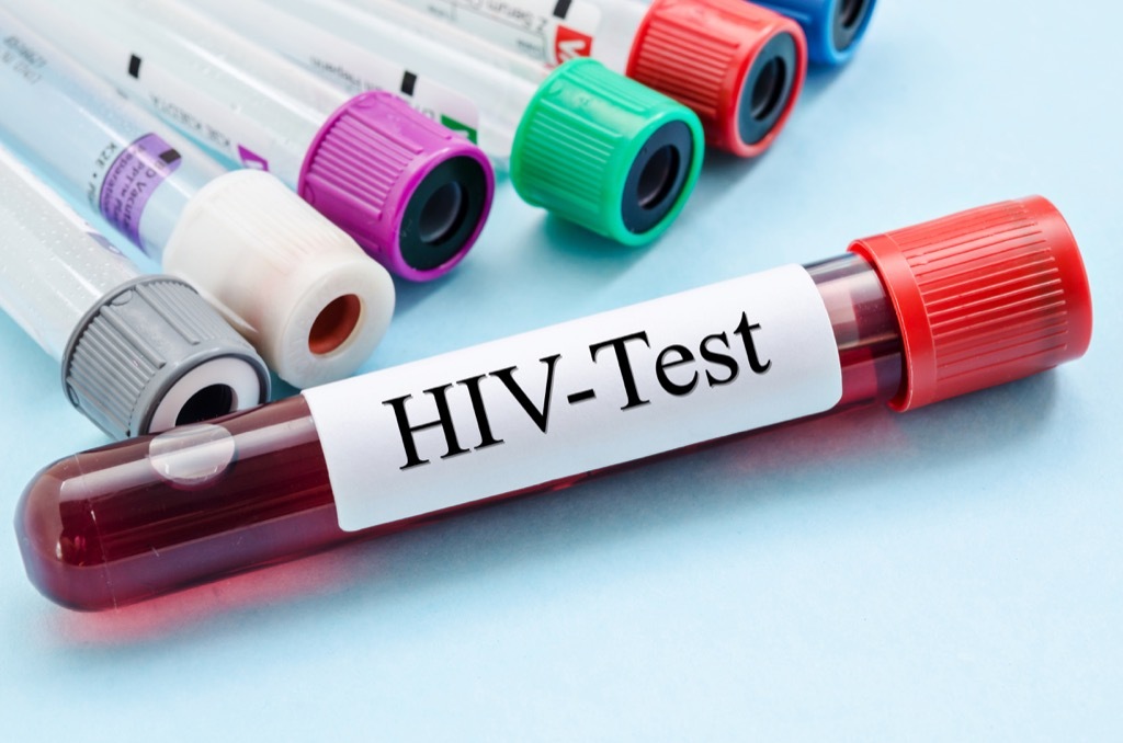 HIV blood test