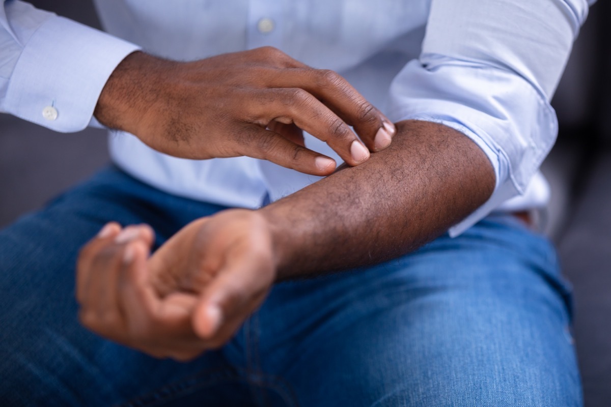 Man Scratching His Hand