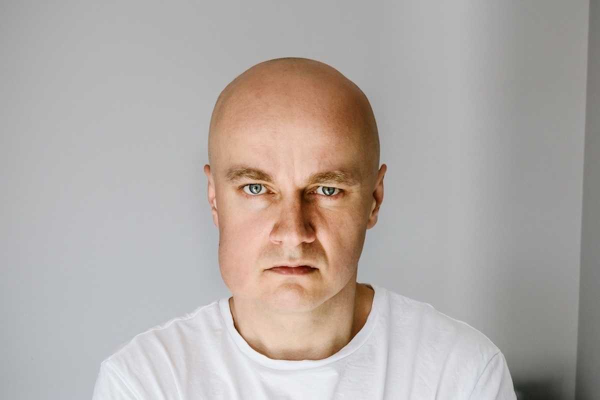 bald man with blue eyes look at camera with swollen lower portion of face